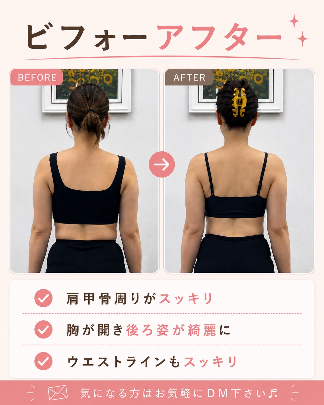 Before After 3